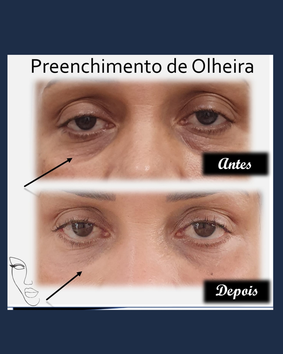 Inserir um títulORELHA RESULTADO